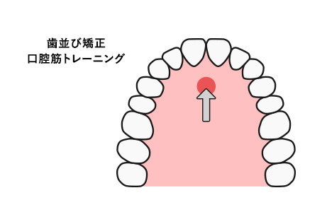 顎の形を決定する 舌のポジション
